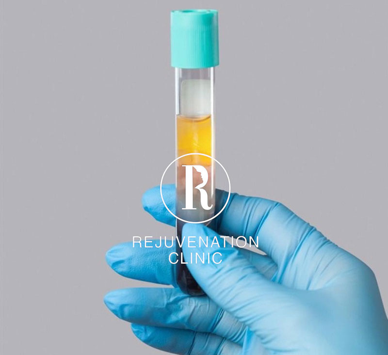 Holistic Training: PRP for Skin Tightening and Hair Restoration